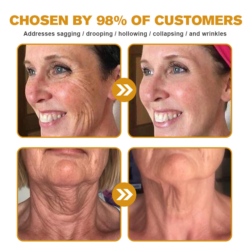 Today 49% OFF Firming Cream (Upgraded Packaging Clinically Backed Results)