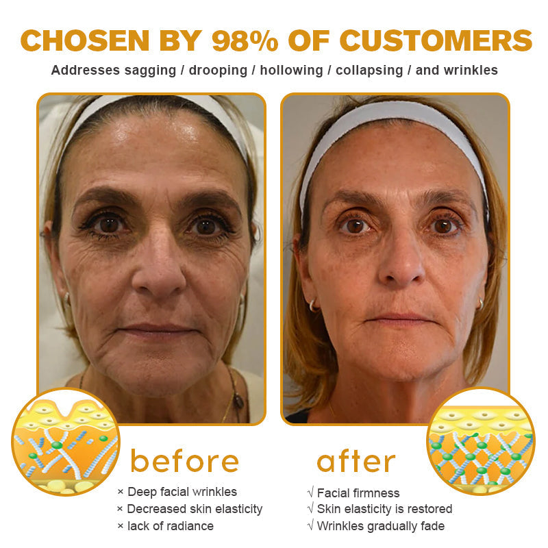 Today 49% OFF Firming Cream (Upgraded Packaging Clinically Backed Results)
